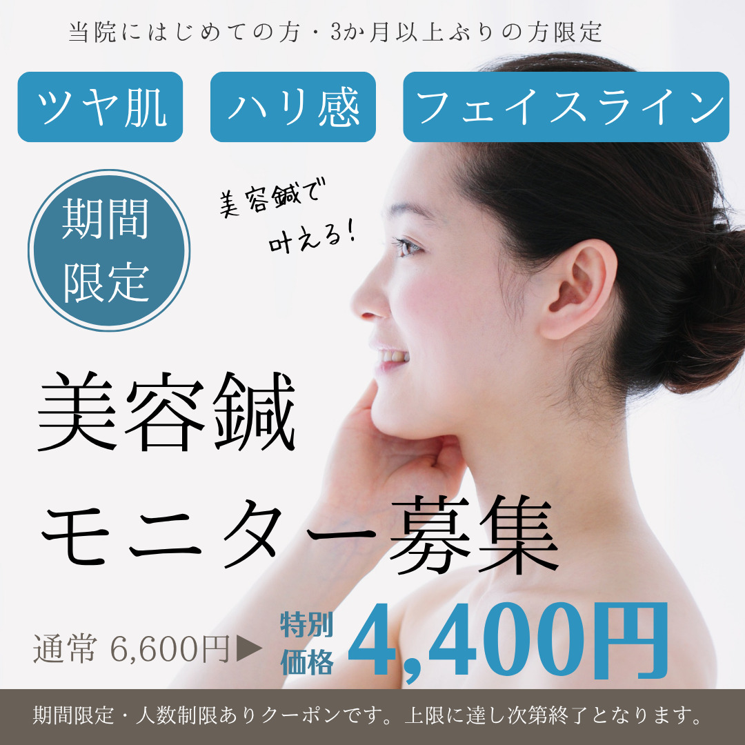 美容鍼モニター様を募集しております！